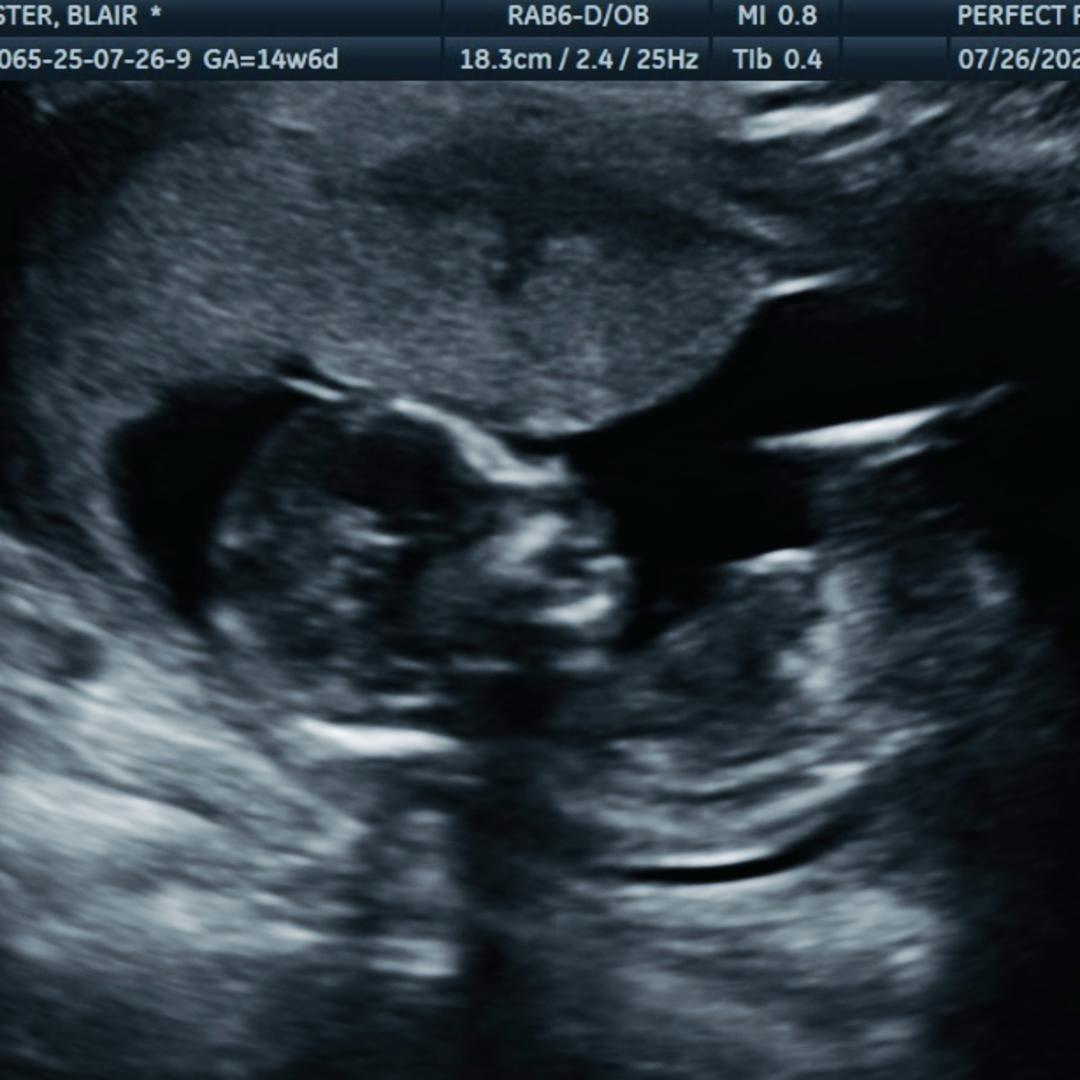 Photo shared by Blair for their Babylist baby registry.