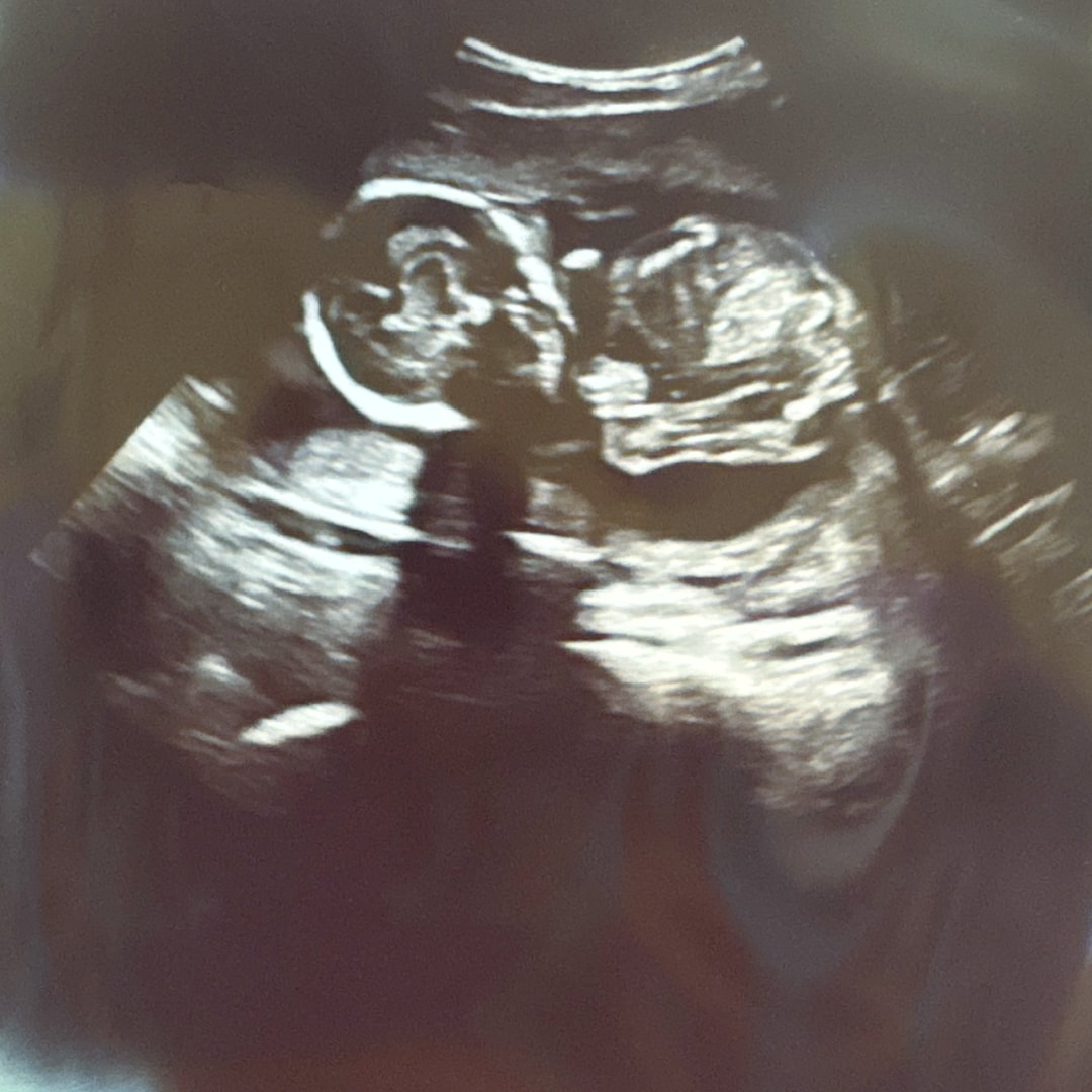 Photo shared by Haley & Zachary for their Babylist baby registry.