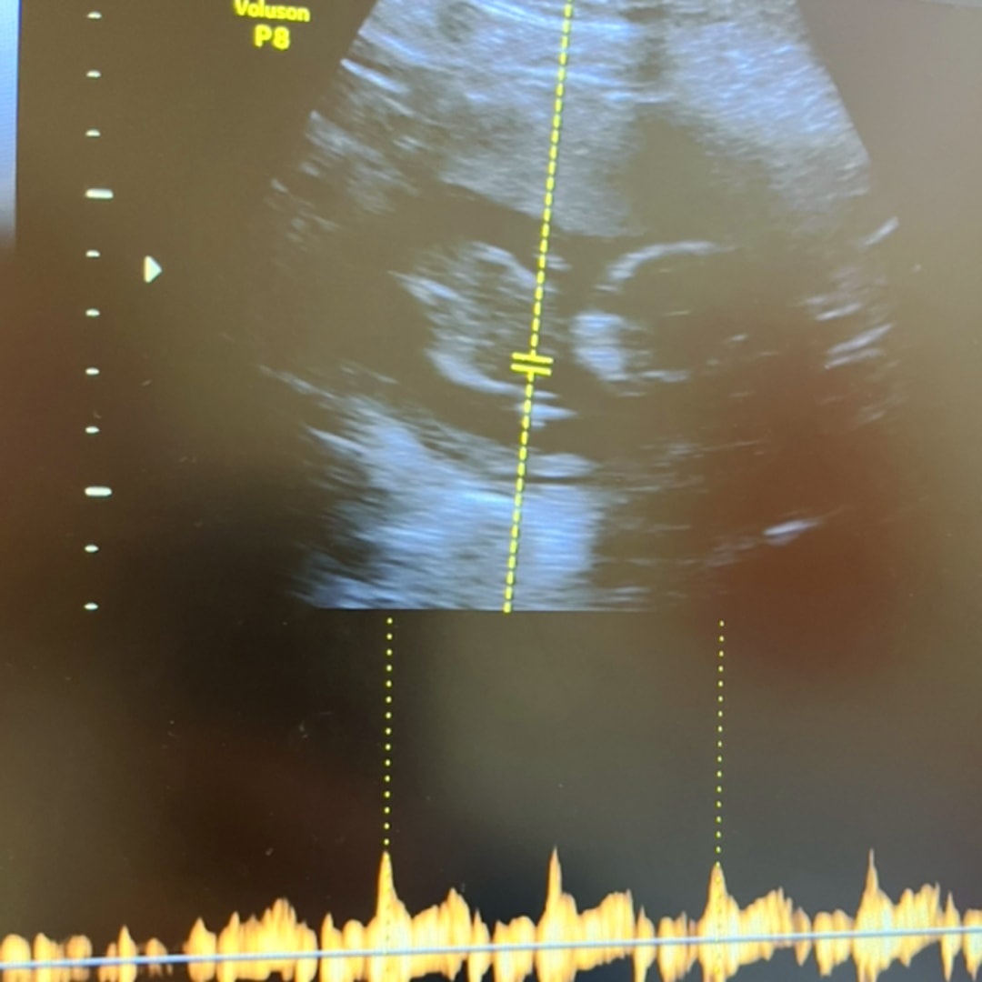 Photo shared by Valentina for their Babylist baby registry.