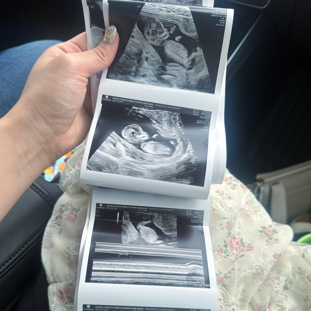 Photo shared by Chrisley Anne for their Babylist baby registry.