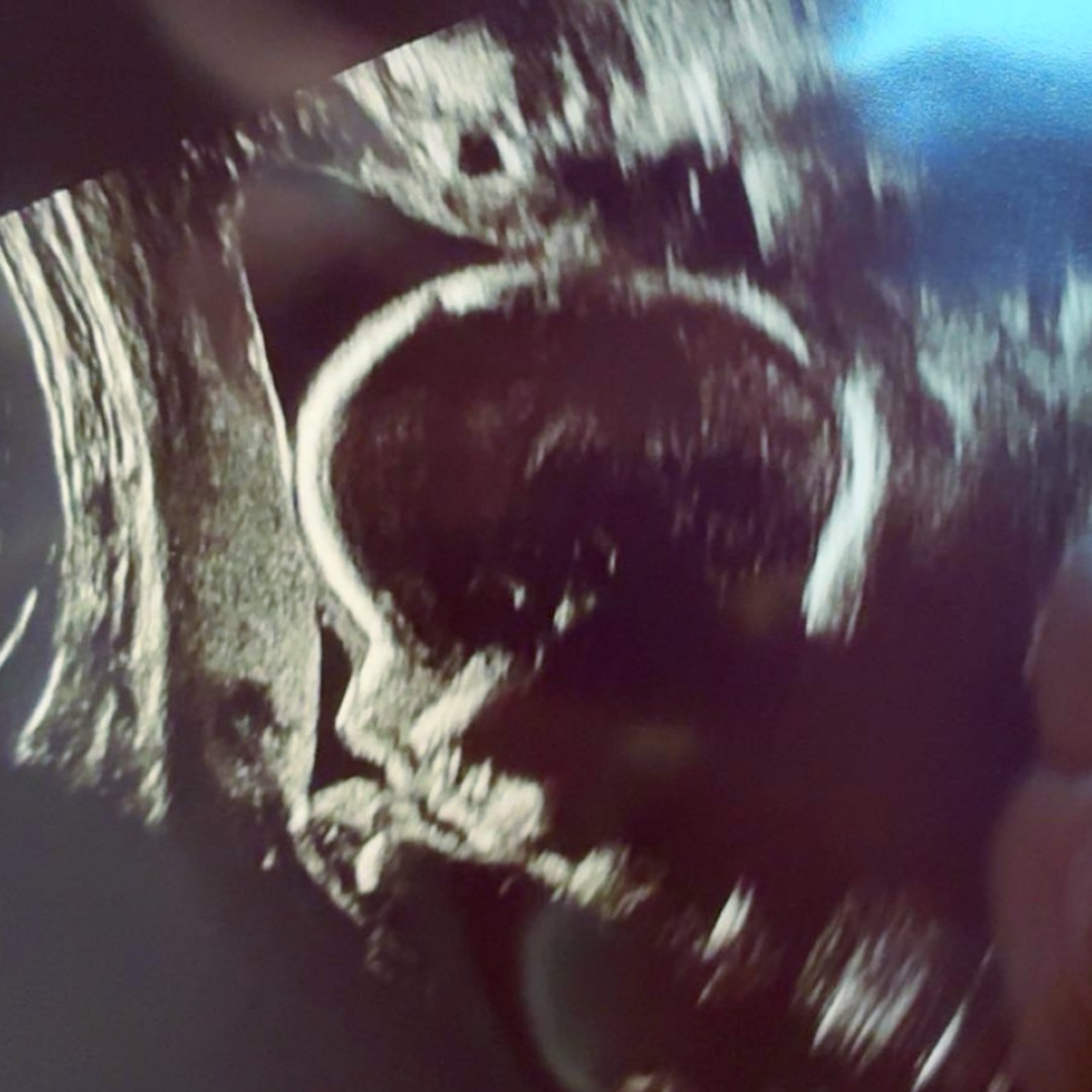 Photo shared by Theresa for their Babylist baby registry.