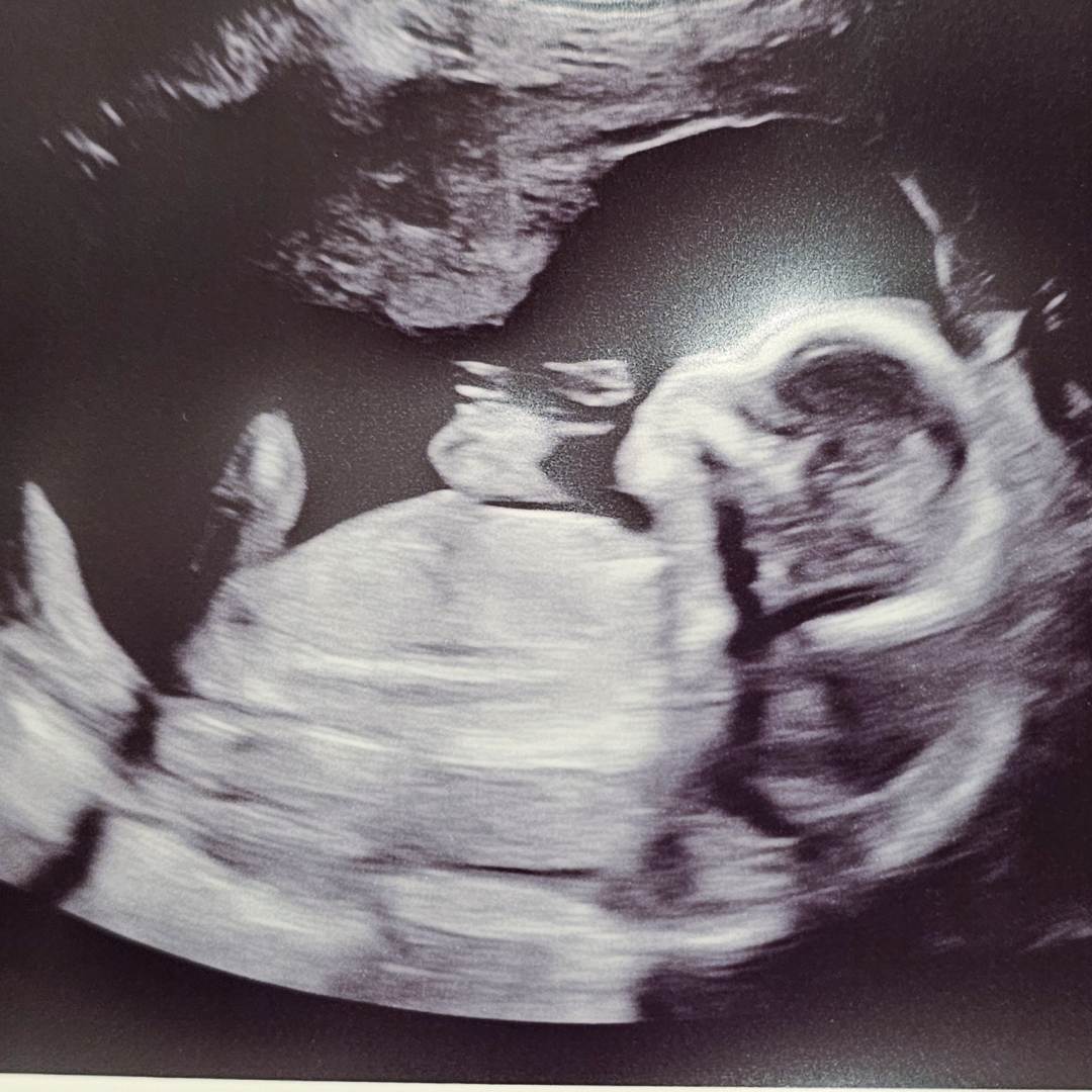 Photo shared by Husna for their Babylist baby registry.