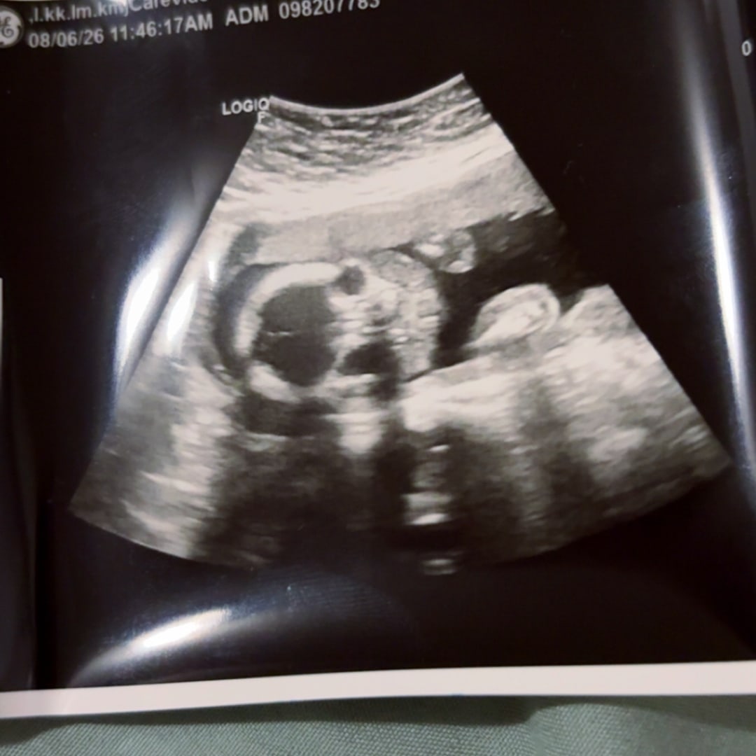 Photo shared by Alyssa for their Babylist baby registry.