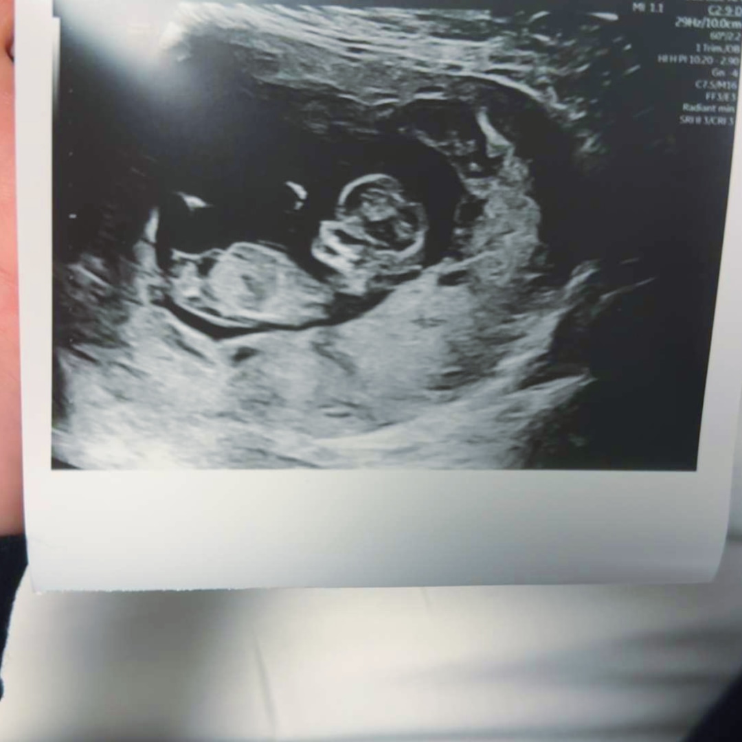 Photo shared by Olivia for their Babylist baby registry.