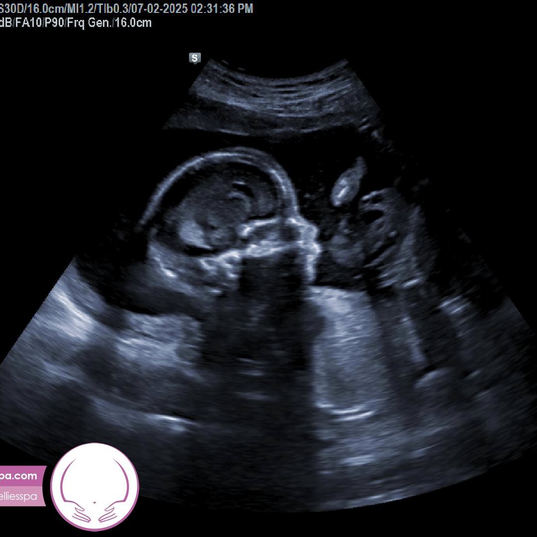 Photo shared by Hannah for their Babylist baby registry.