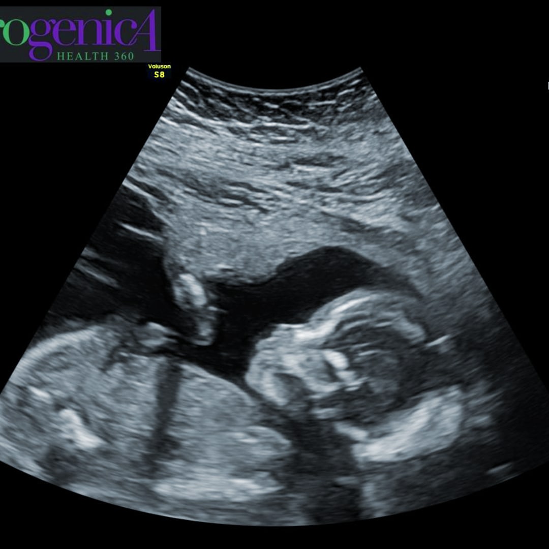 Photo shared by Carolyn for their Babylist baby registry.