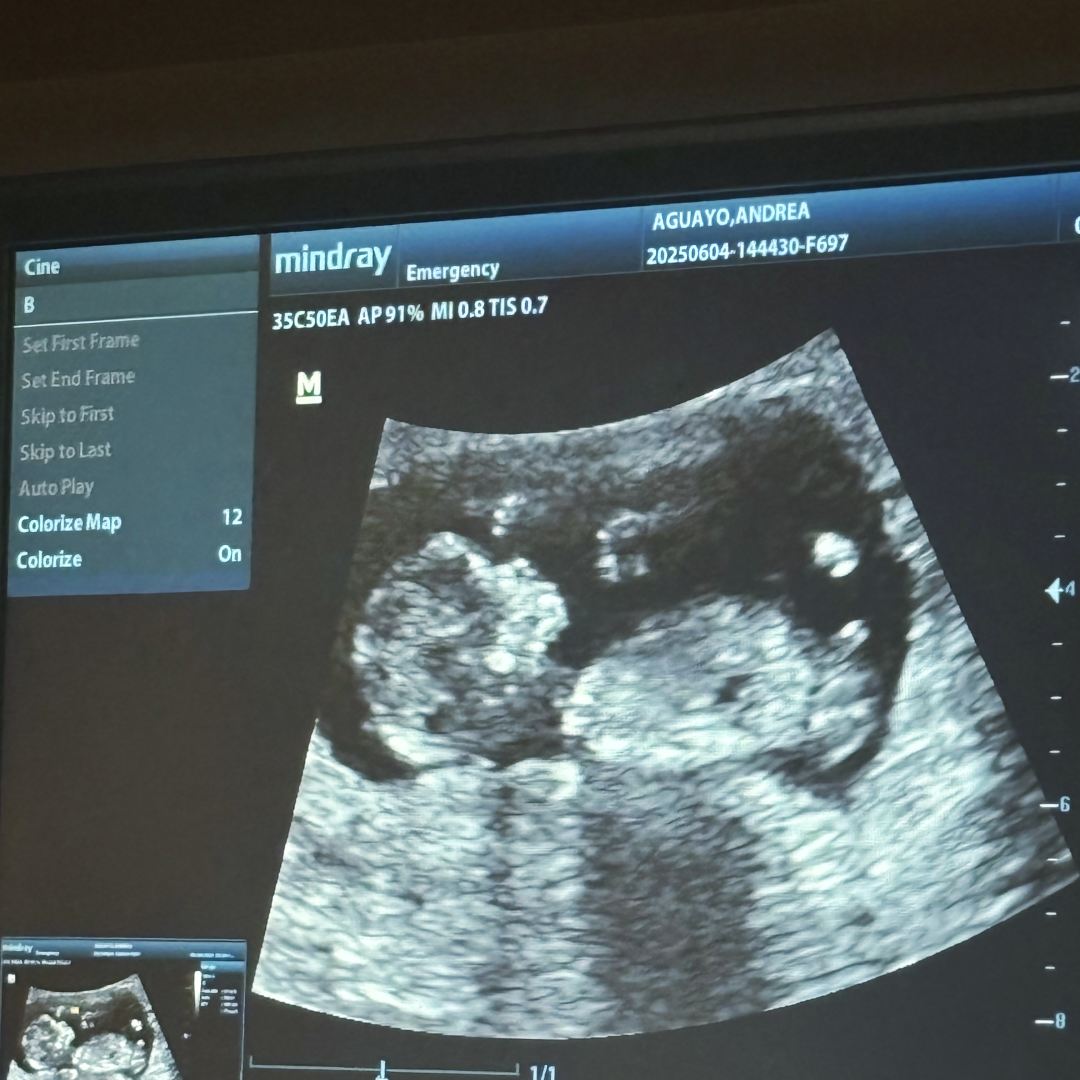 Photo shared by Annie for their Babylist baby registry.