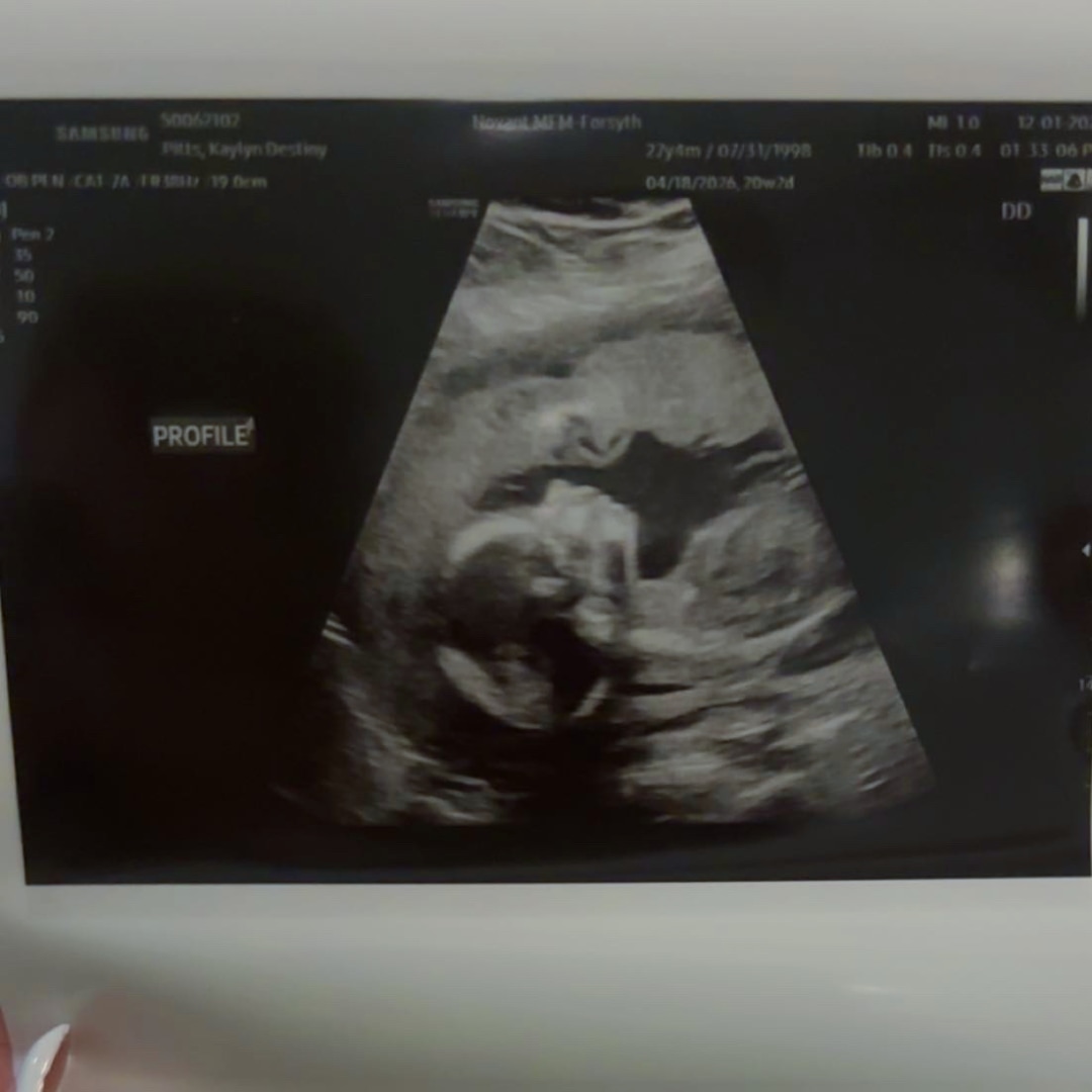 Photo shared by Kelly for their Babylist baby registry.