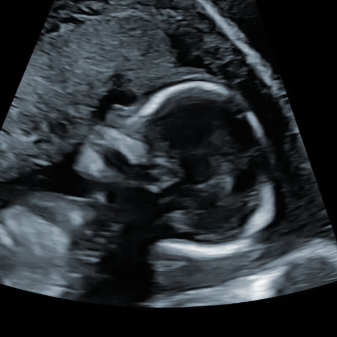 Photo shared by Devin for their Babylist baby registry.