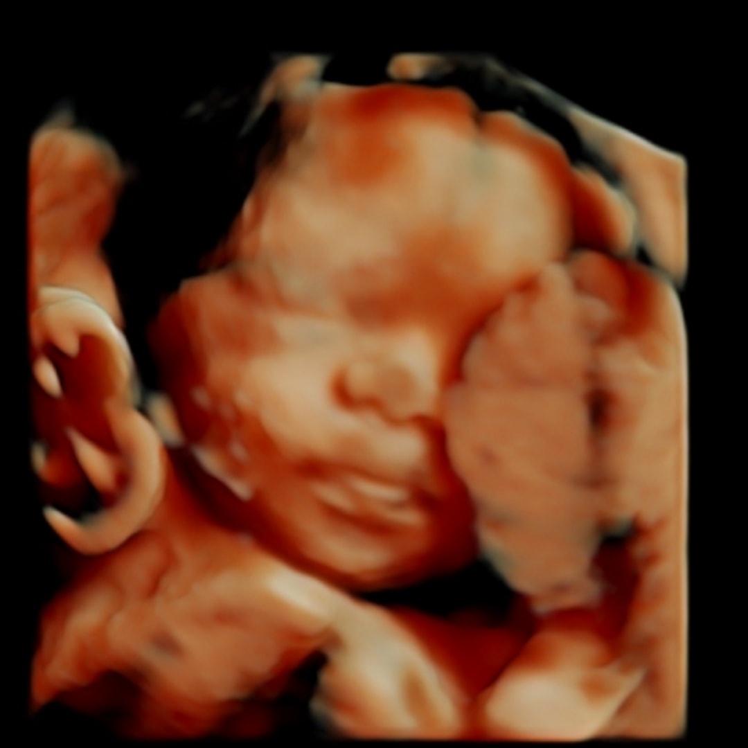 Photo shared by Emily for their Babylist baby registry.
