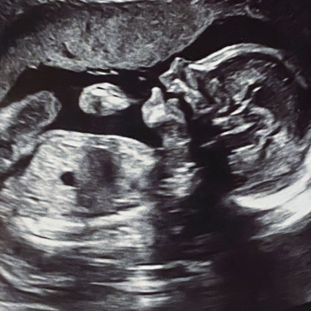 Photo shared by Harli for their Babylist baby registry.