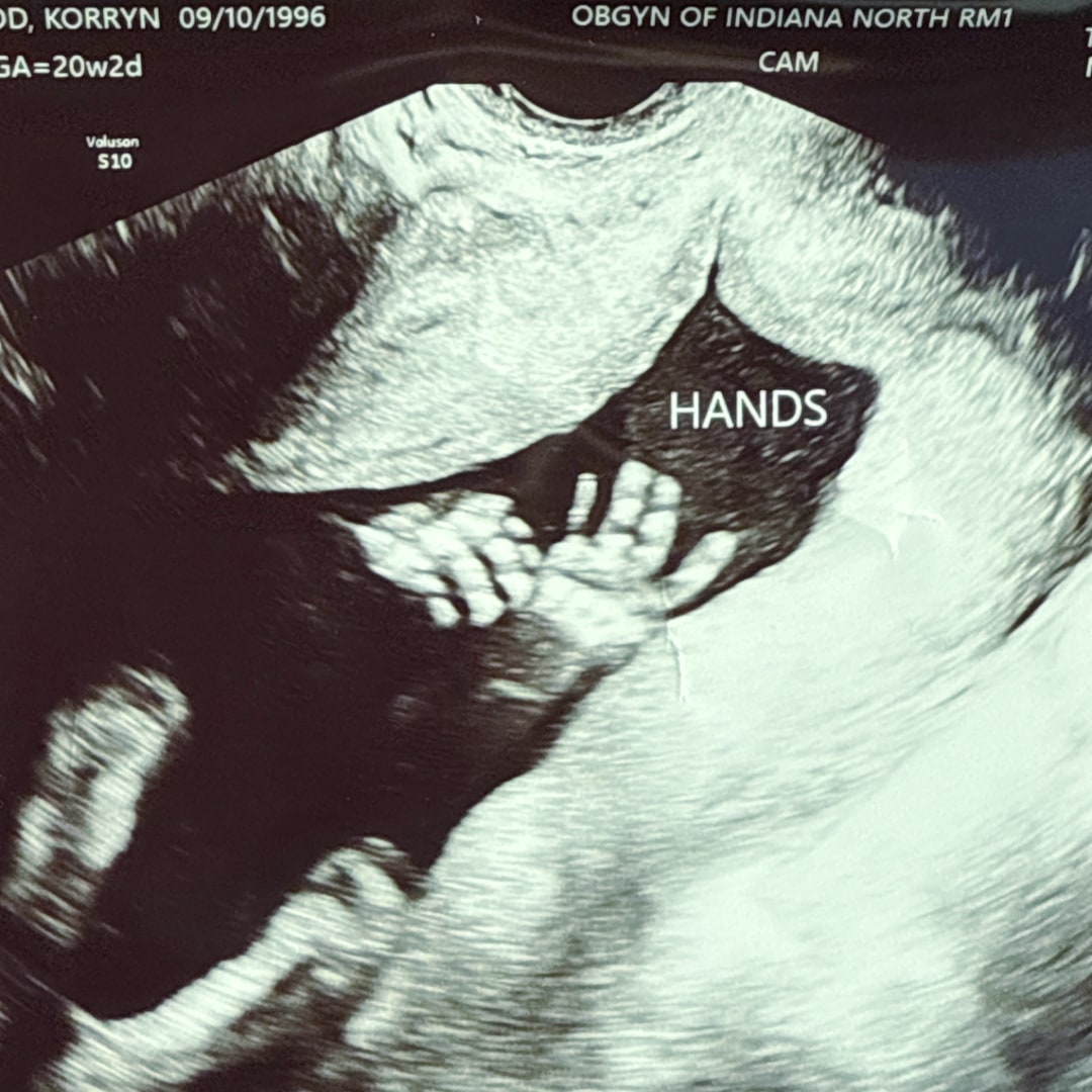 Photo shared by Korryn for their Babylist baby registry.