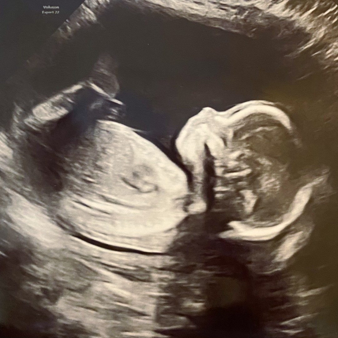 Photo shared by Cara for their Babylist baby registry.