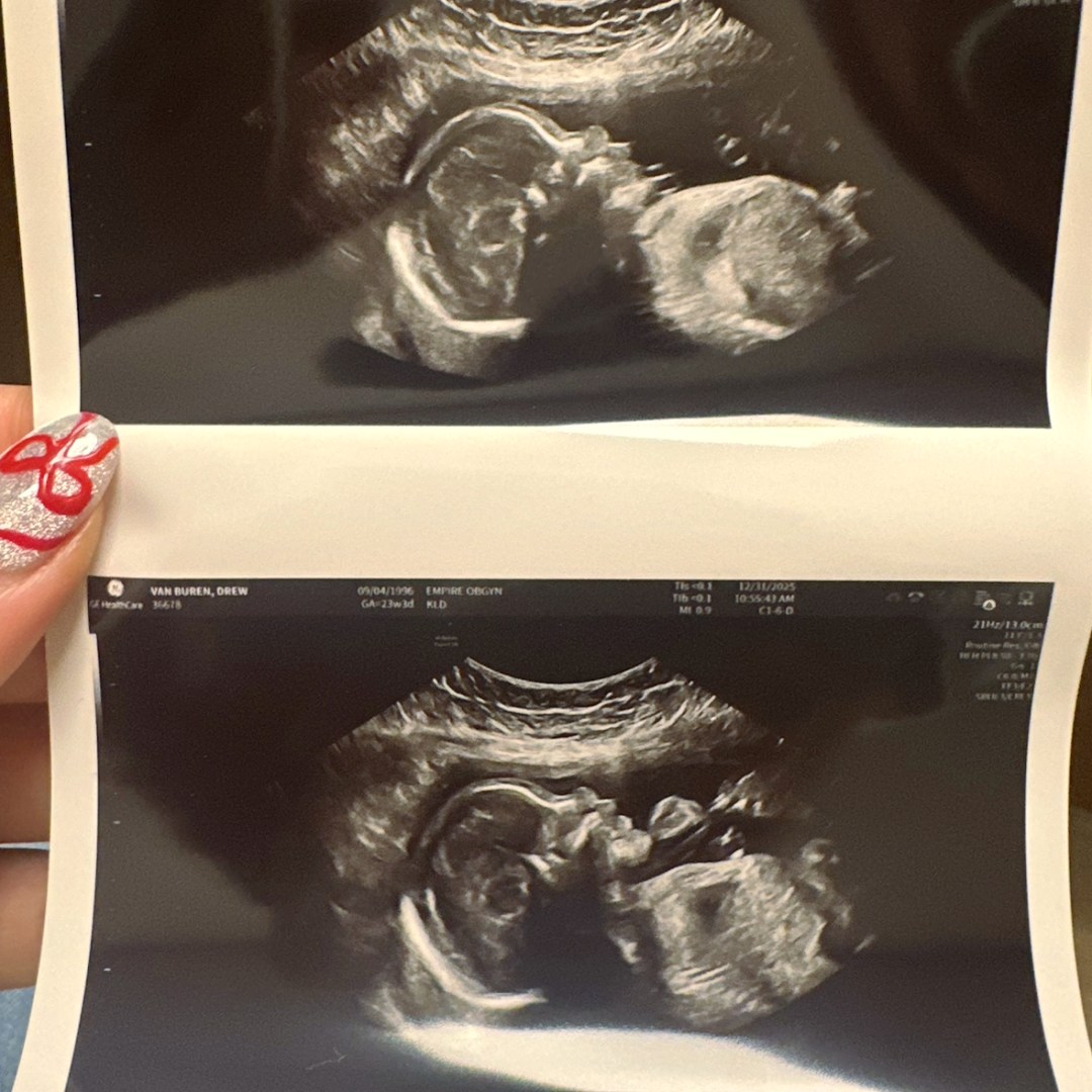 Photo shared by Drew for their Babylist baby registry.