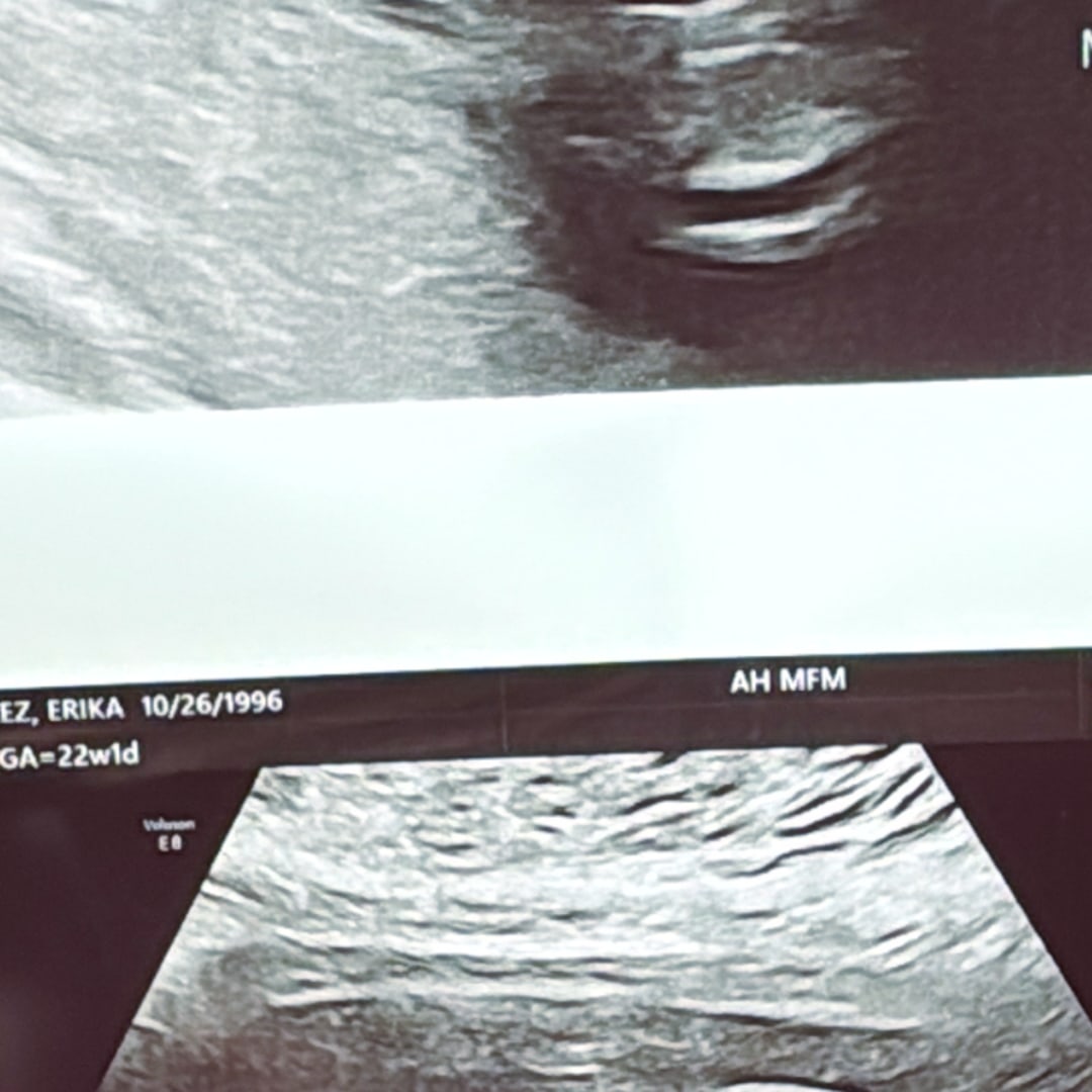 Photo shared by Erika for their Babylist baby registry.