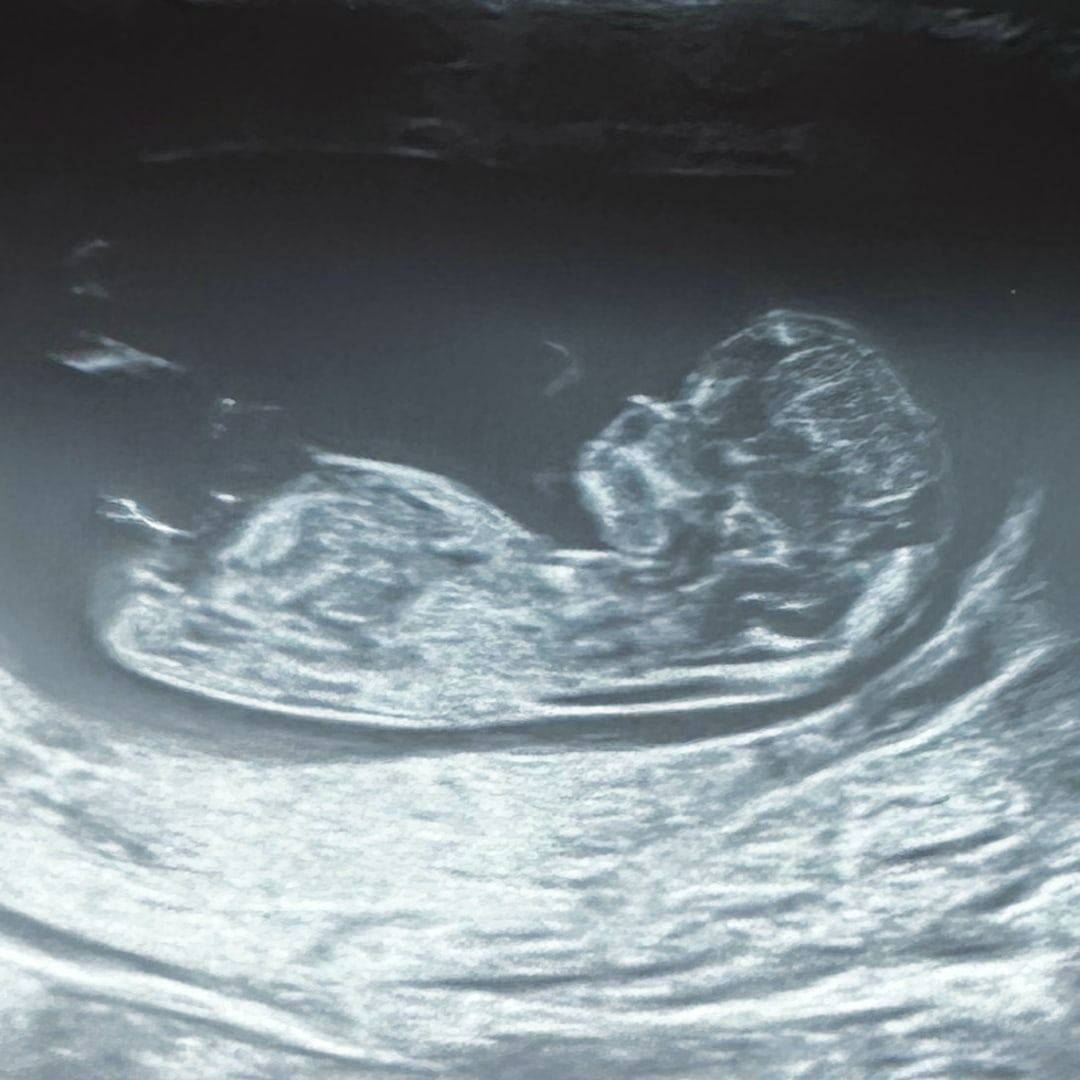 Photo shared by Caitlin for their Babylist baby registry.