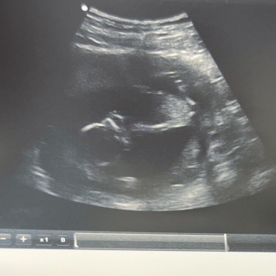 Photo shared by Alexis for their Babylist baby registry.