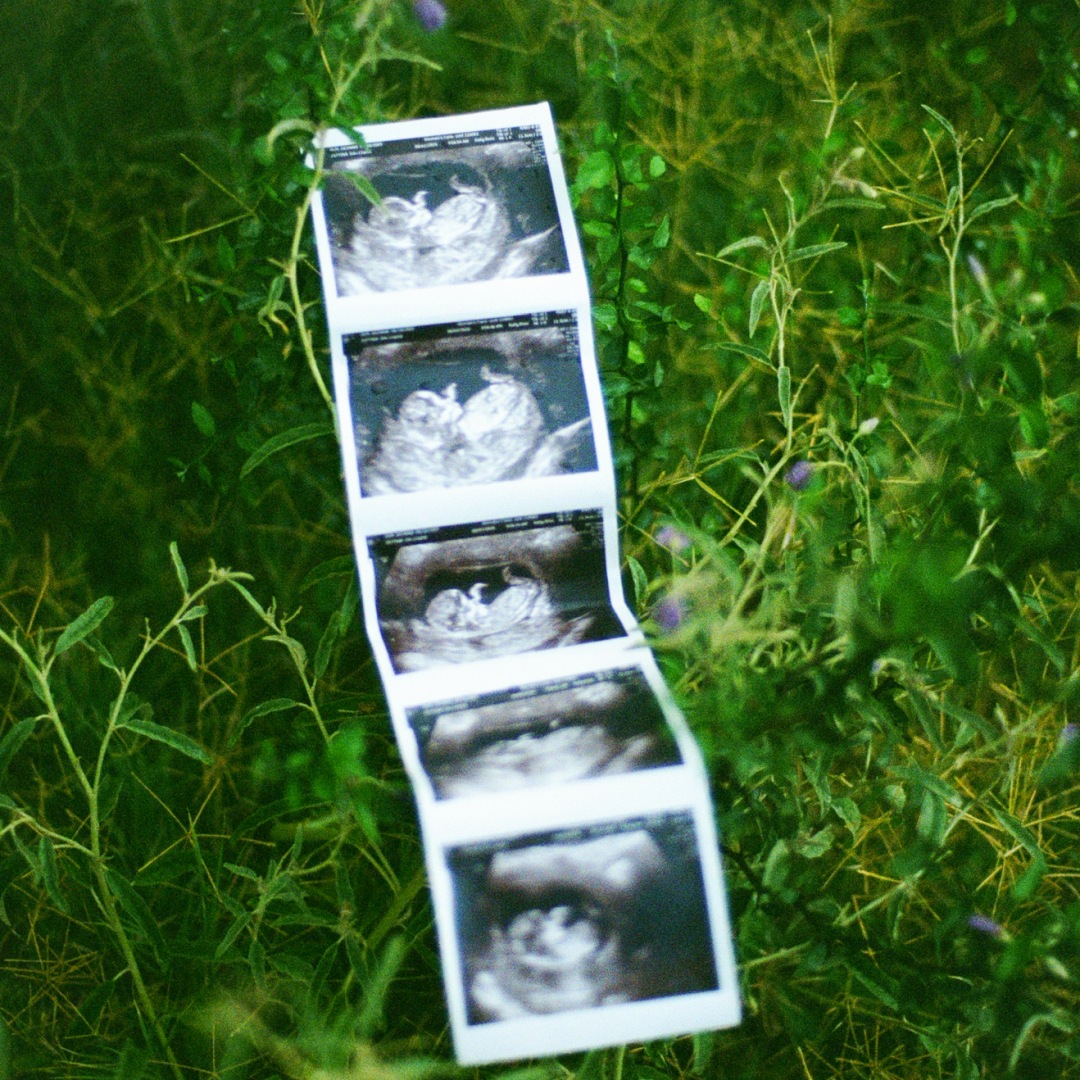 Photo shared by Deonna for their Babylist baby registry.