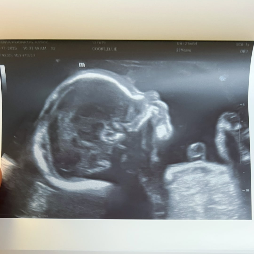 Photo shared by Ellie for their Babylist baby registry.
