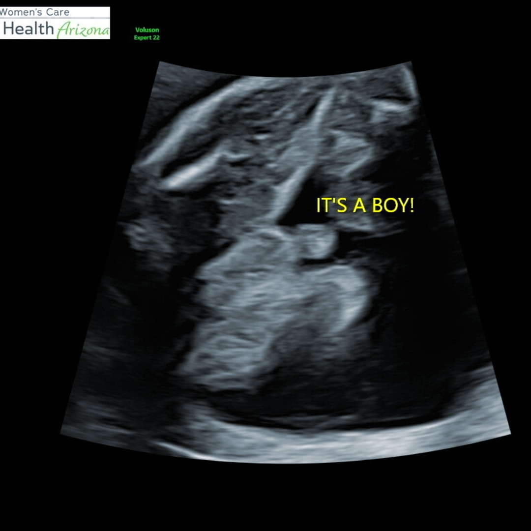 Photo shared by Eliza for their Babylist baby registry.