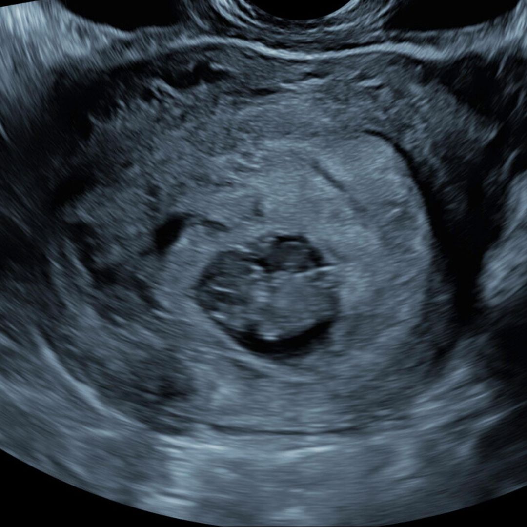 Photo shared by Nick for their Babylist baby registry.