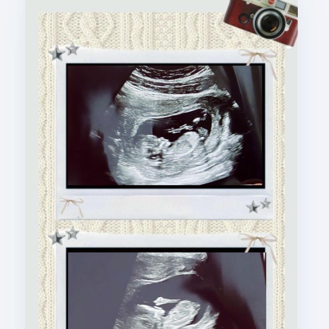 Photo shared by Kia for their Babylist baby registry.