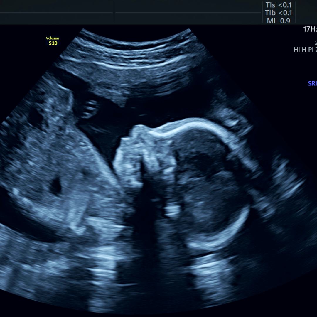 Photo shared by Alexia for their Babylist baby registry.