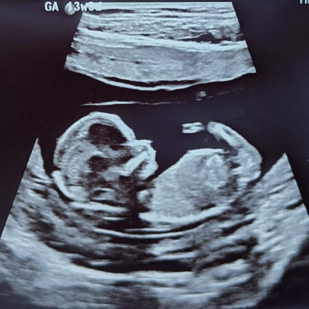 Photo shared by Emma for their Babylist baby registry.