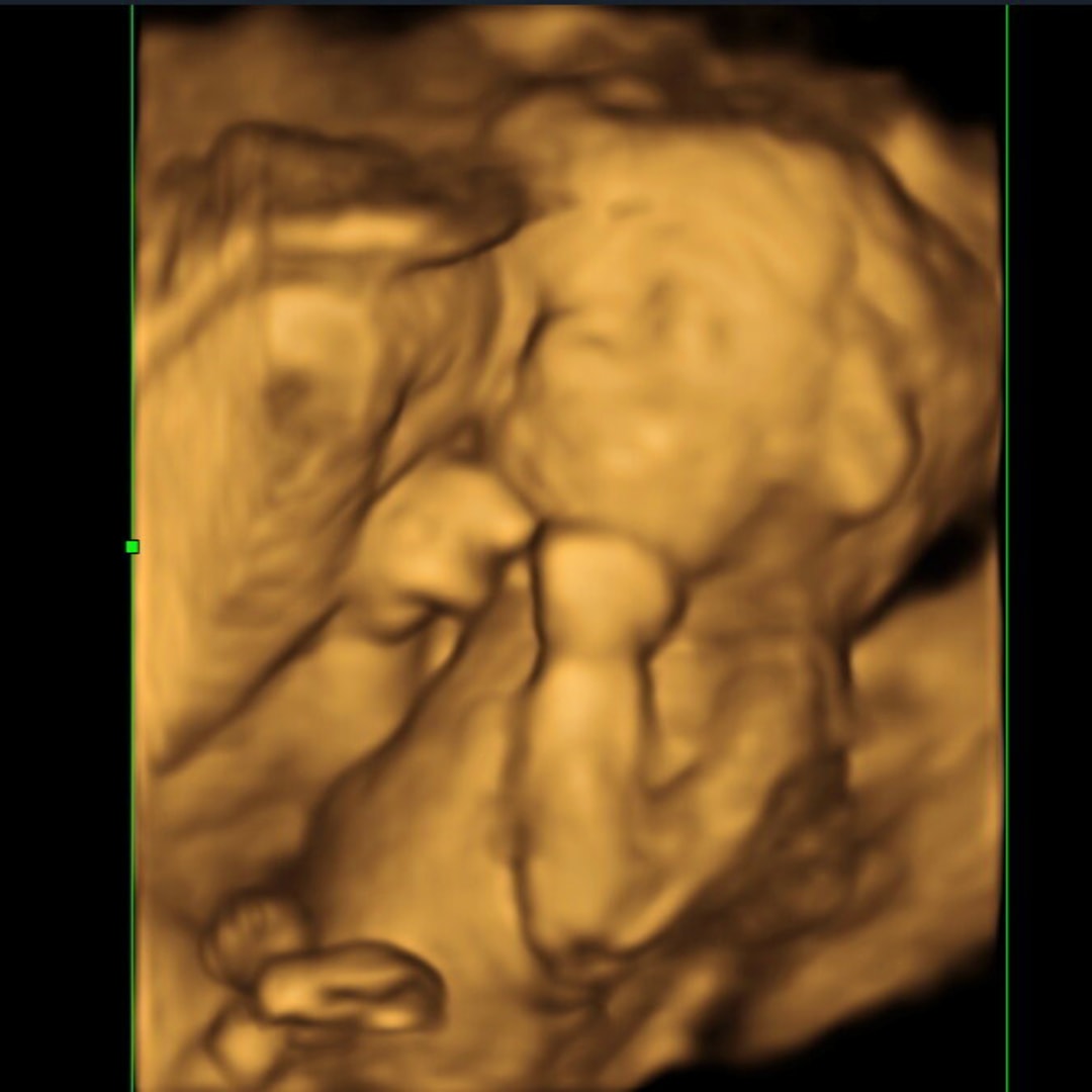 Photo shared by Diamond for their Babylist baby registry.