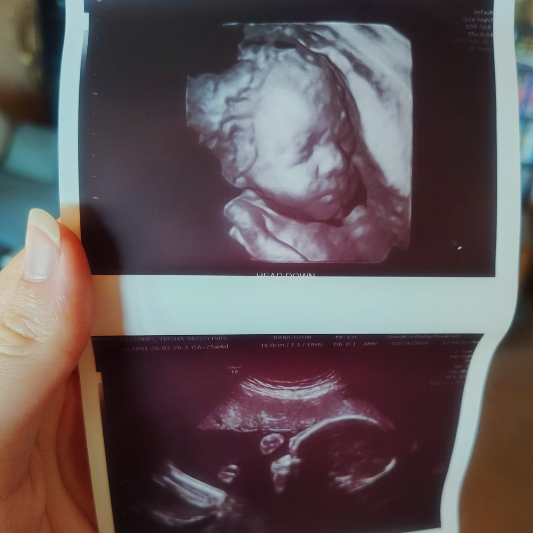 Photo shared by Trish for their Babylist baby registry.