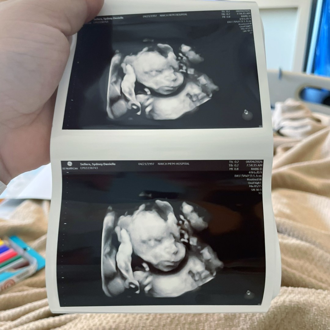 Photo shared by Sydney for their Babylist baby registry.