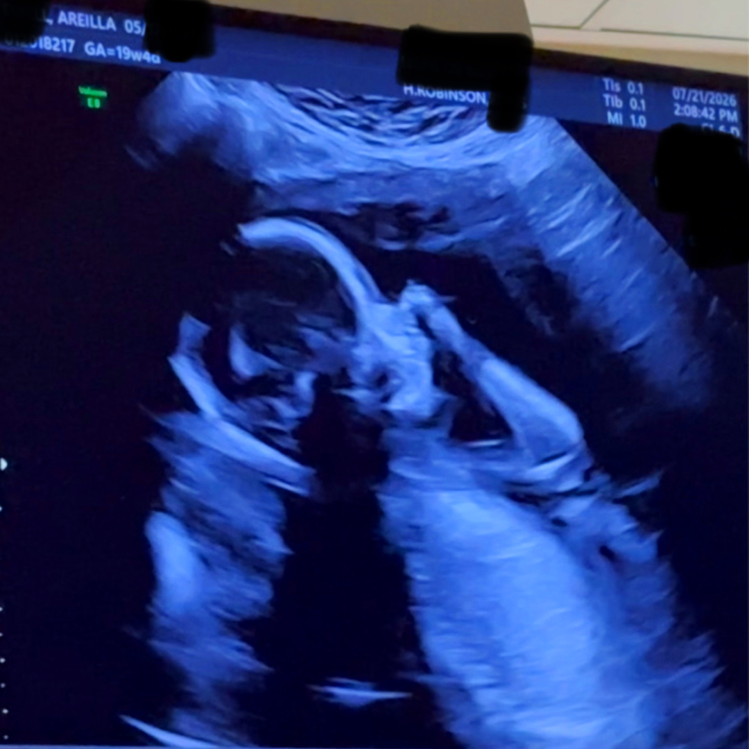 Photo shared by Ari for their Babylist baby registry.
