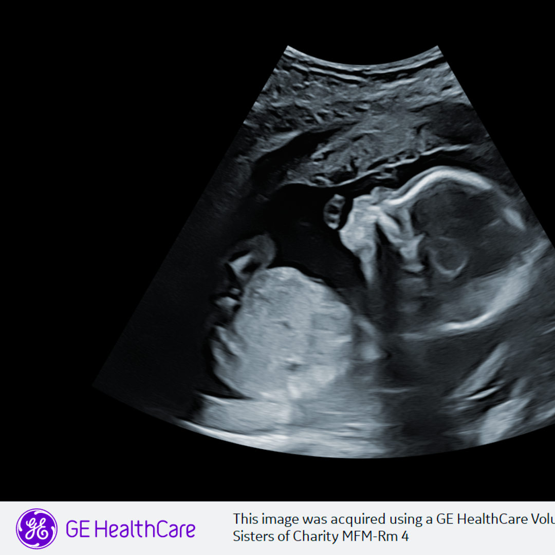 Photo shared by Neve for their Babylist baby registry.