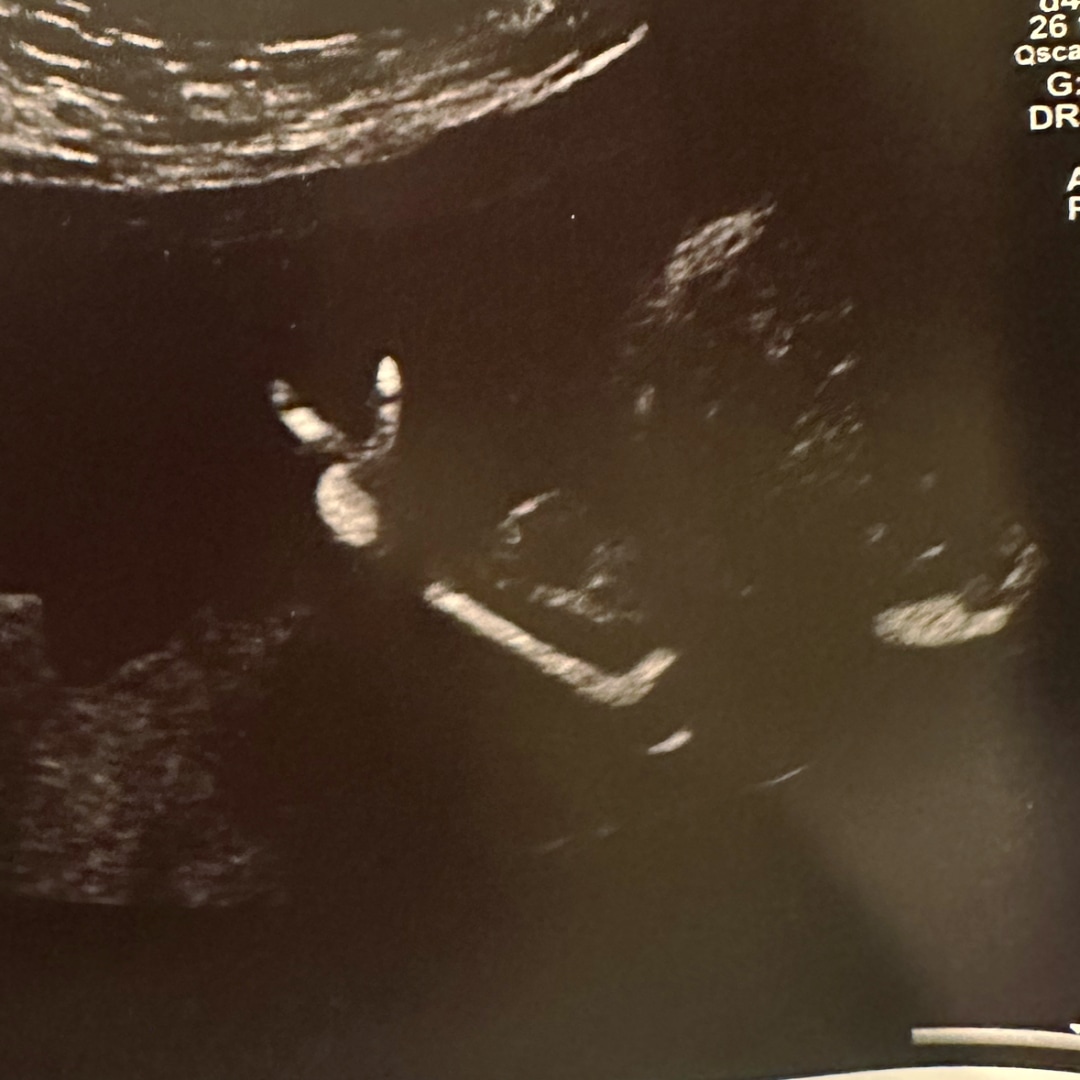 Photo shared by Spencer for their Babylist baby registry.