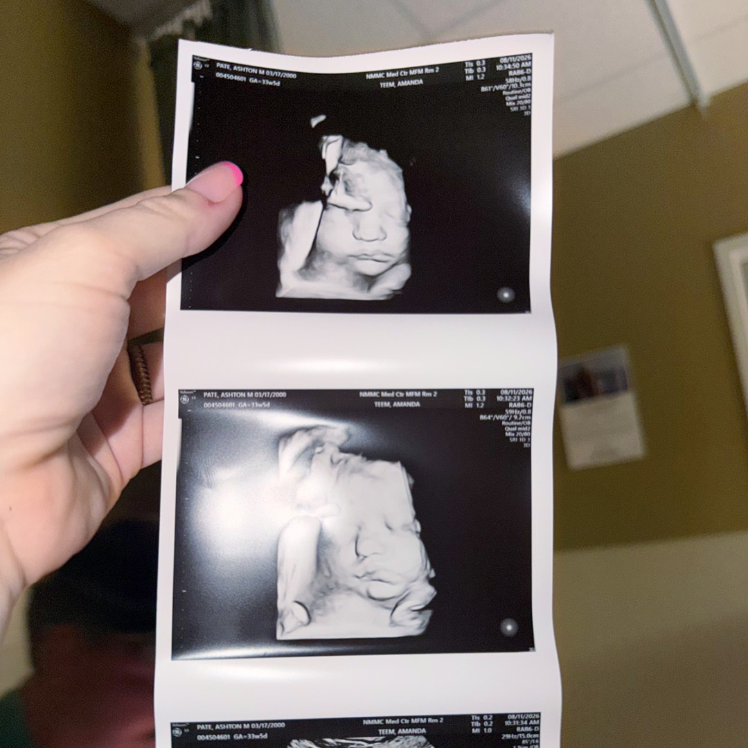 Photo shared by Mackenzie for their Babylist baby registry.