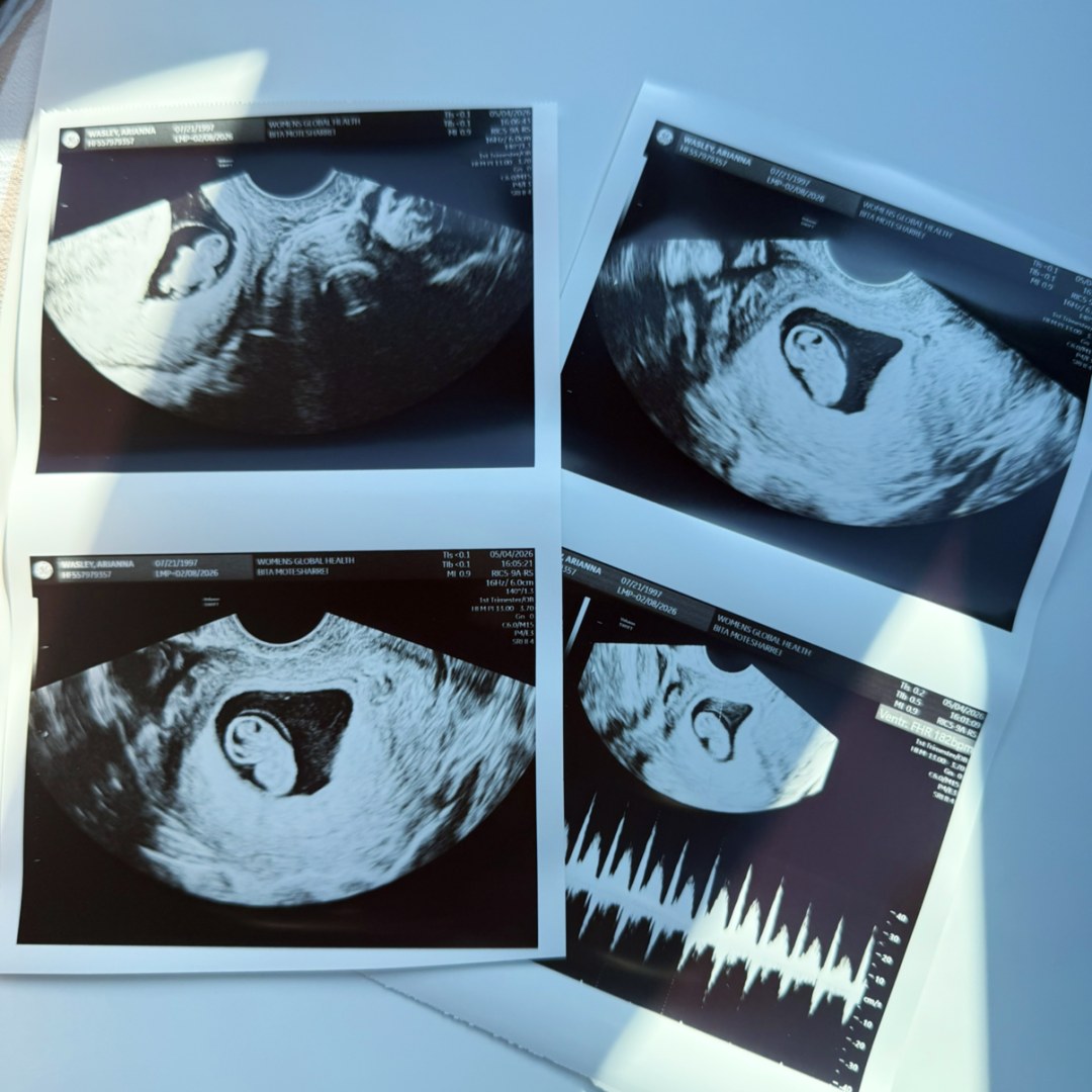 Photo shared by Arianna for their Babylist baby registry.
