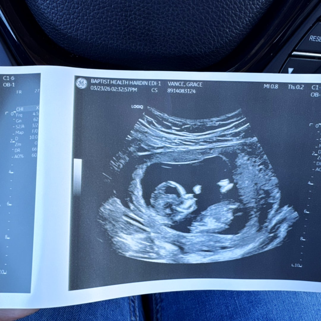 Photo shared by Grace for their Babylist baby registry.