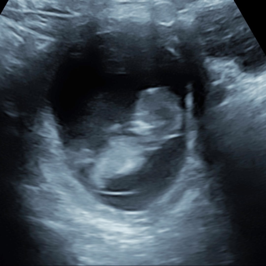 Photo shared by Holly for their Babylist baby registry.