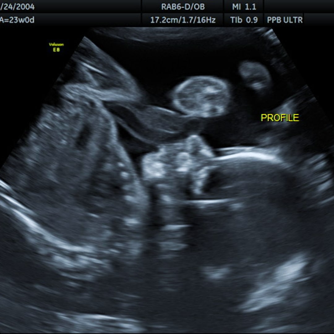 Photo shared by Samantha for their Babylist baby registry.