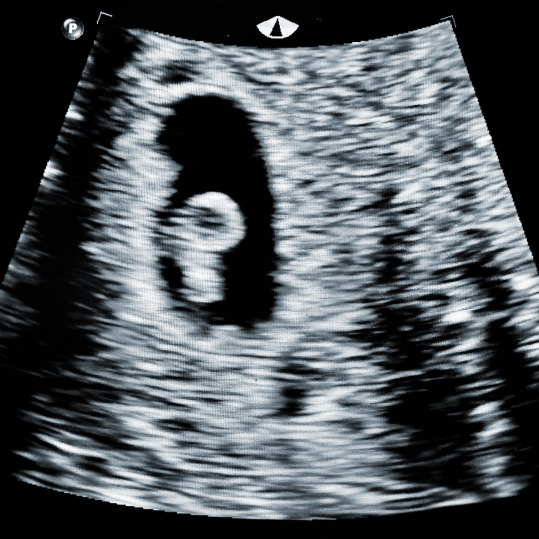 Photo shared by Angela for their Babylist baby registry.