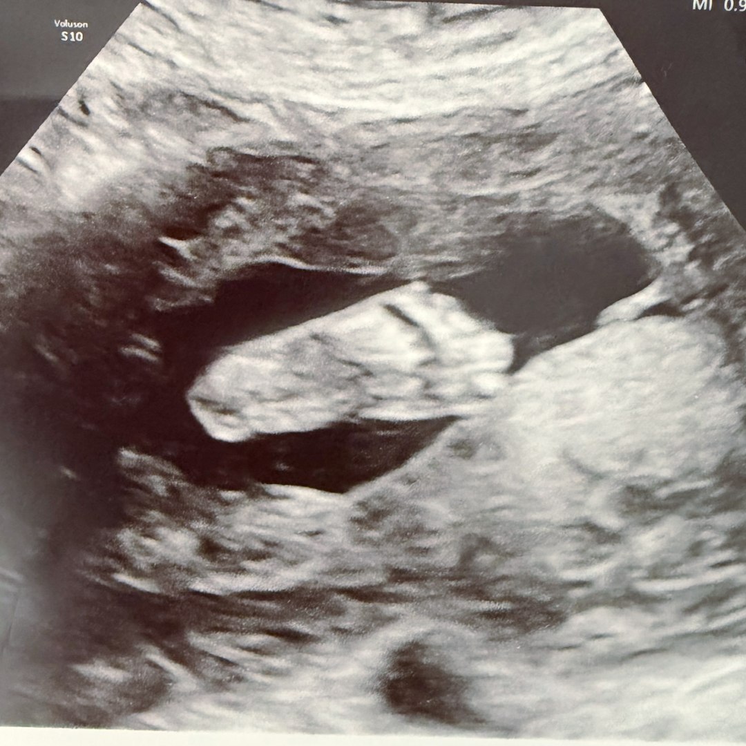 Photo shared by Elizabeth for their Babylist baby registry.