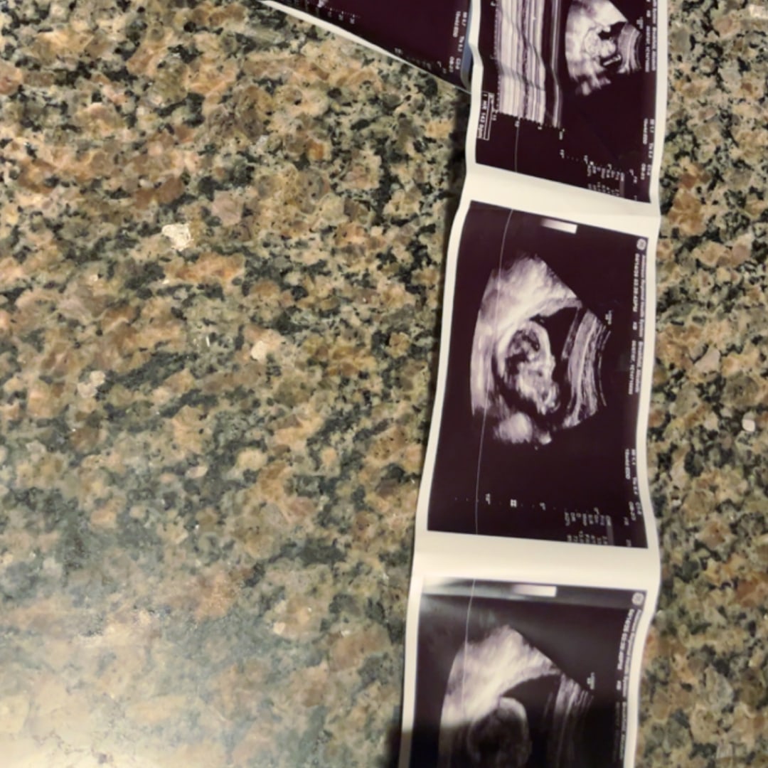 Photo shared by Alizabeth for their Babylist baby registry.