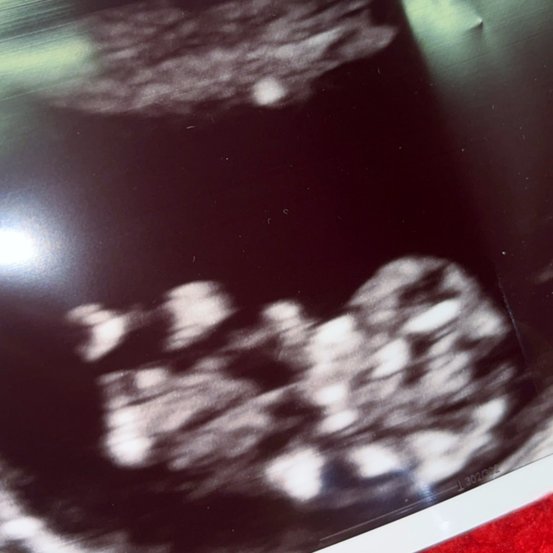 Photo shared by Mckendra for their Babylist baby registry.