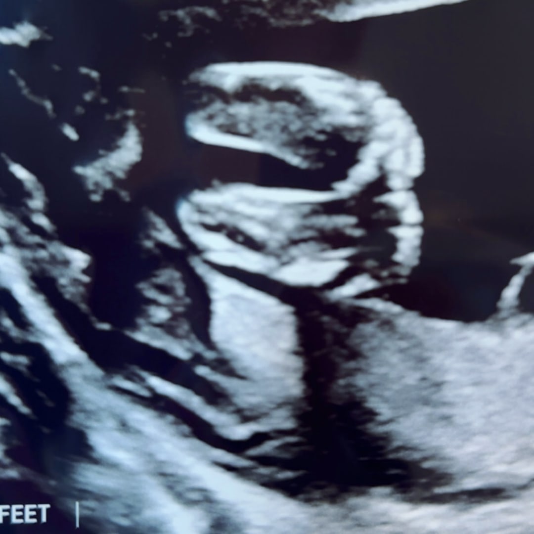 Photo shared by Breonna for their Babylist baby registry.