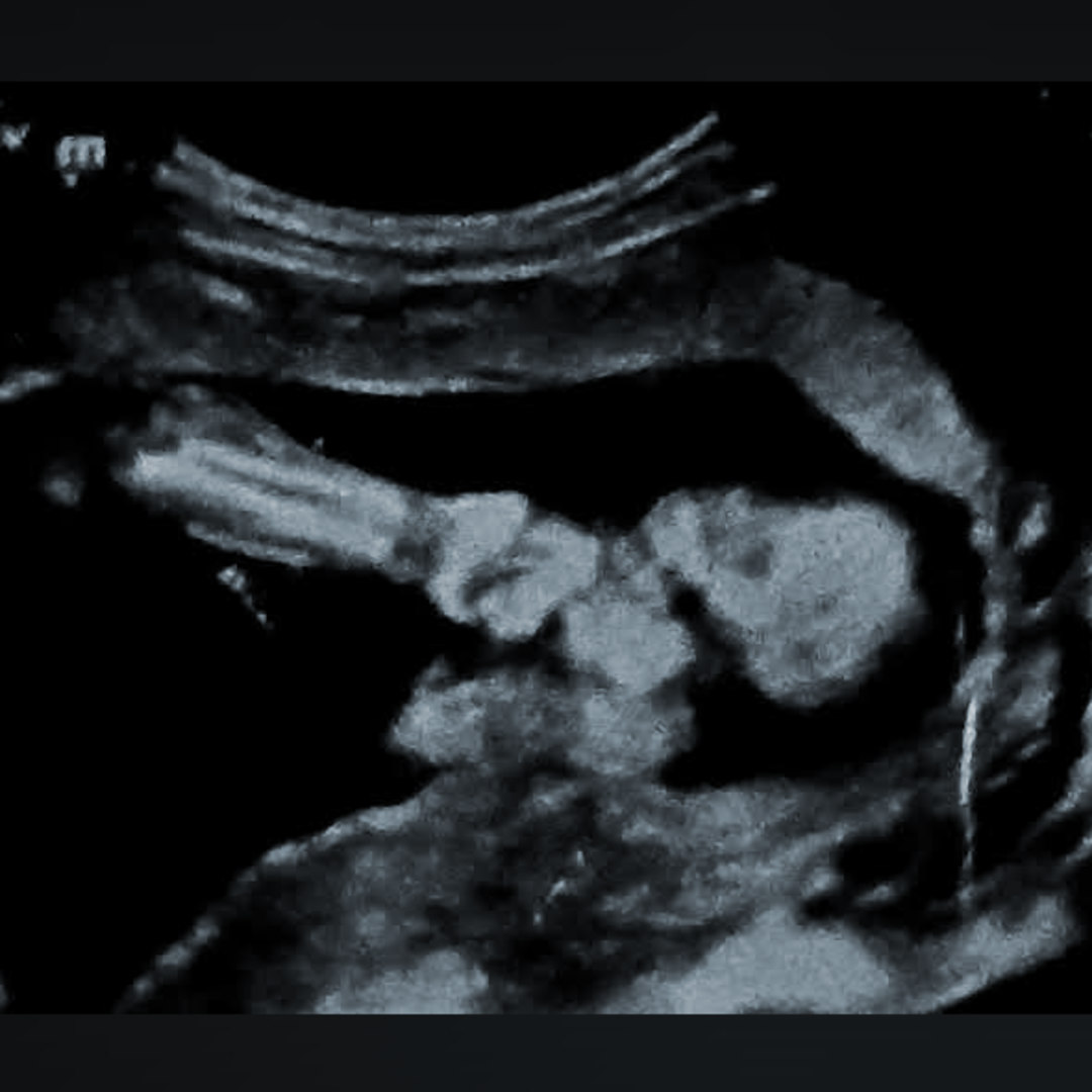 Photo shared by Bethany for their Babylist baby registry.