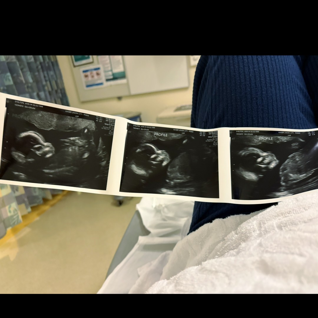 Photo shared by Ann for their Babylist baby registry.