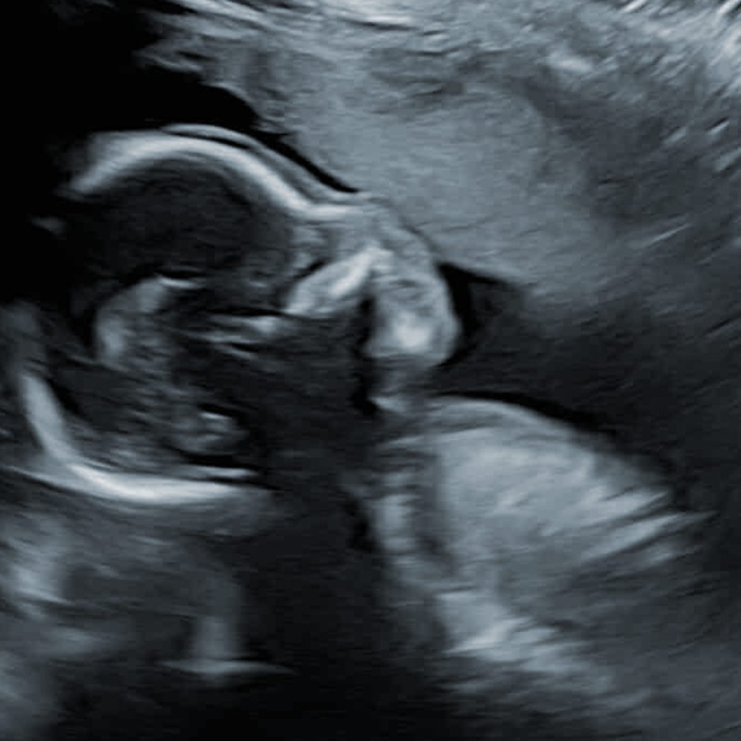 Photo shared by Skye for their Babylist baby registry.