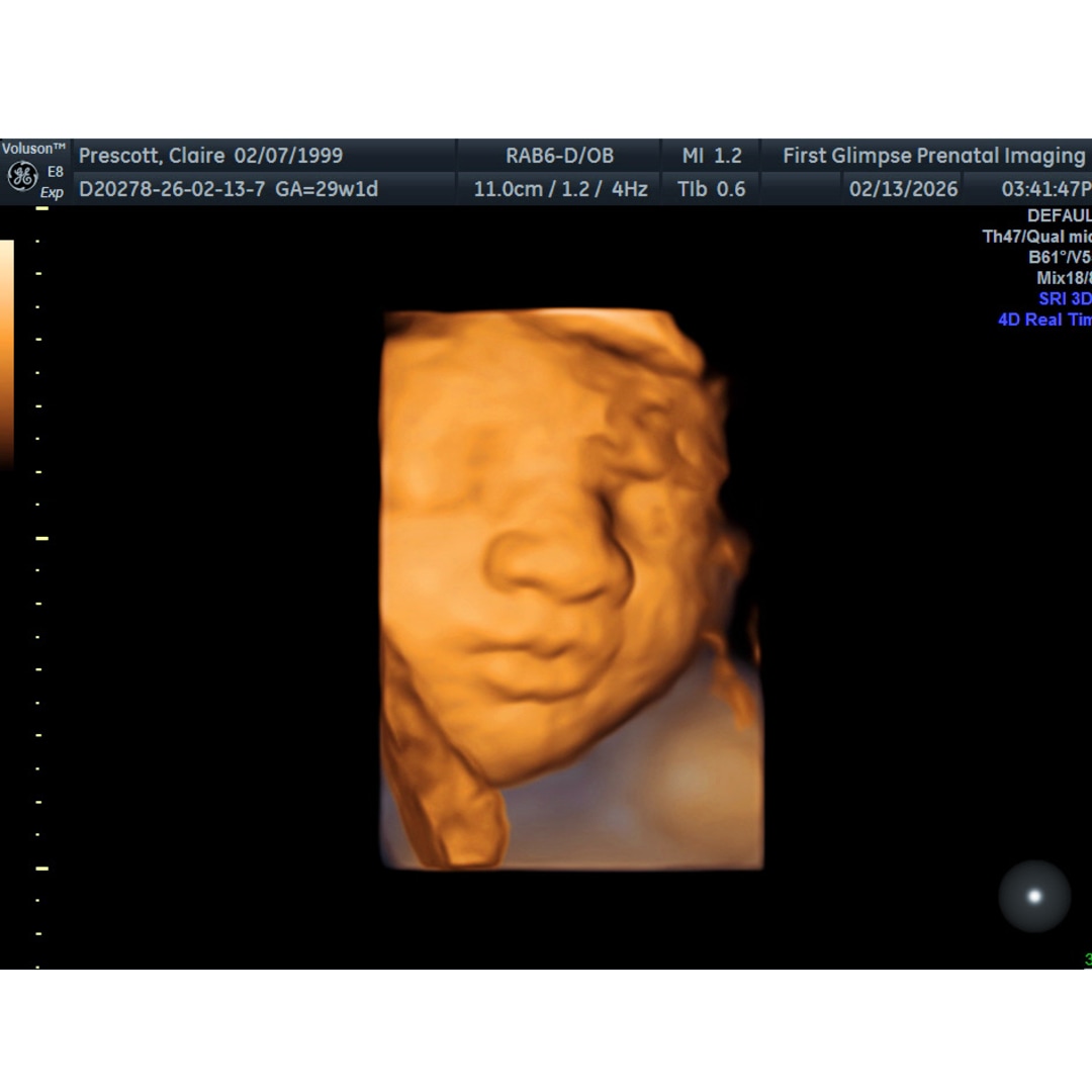 Photo shared by Claire for their Babylist baby registry.