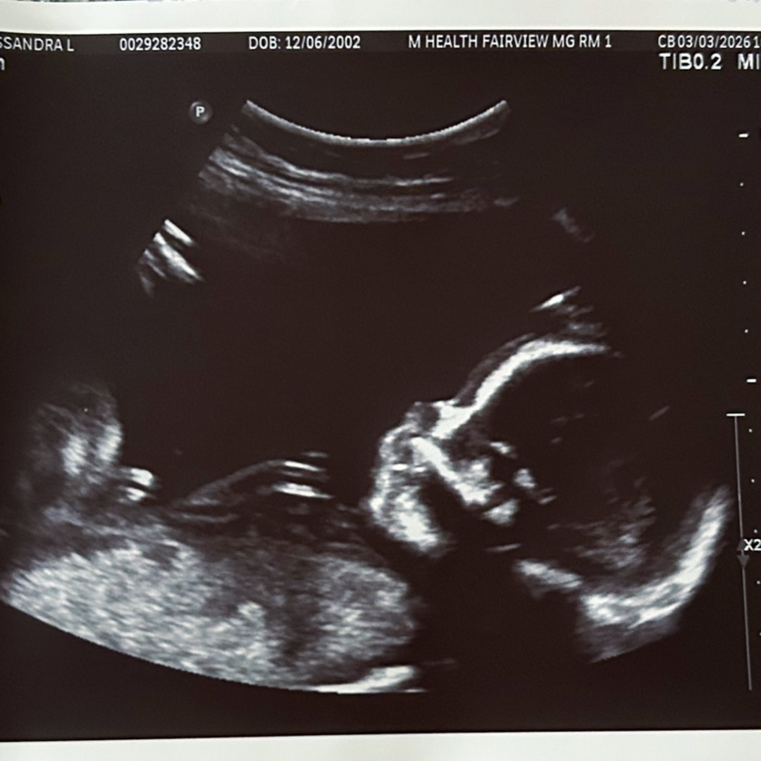 Photo shared by Cassie for their Babylist baby registry.