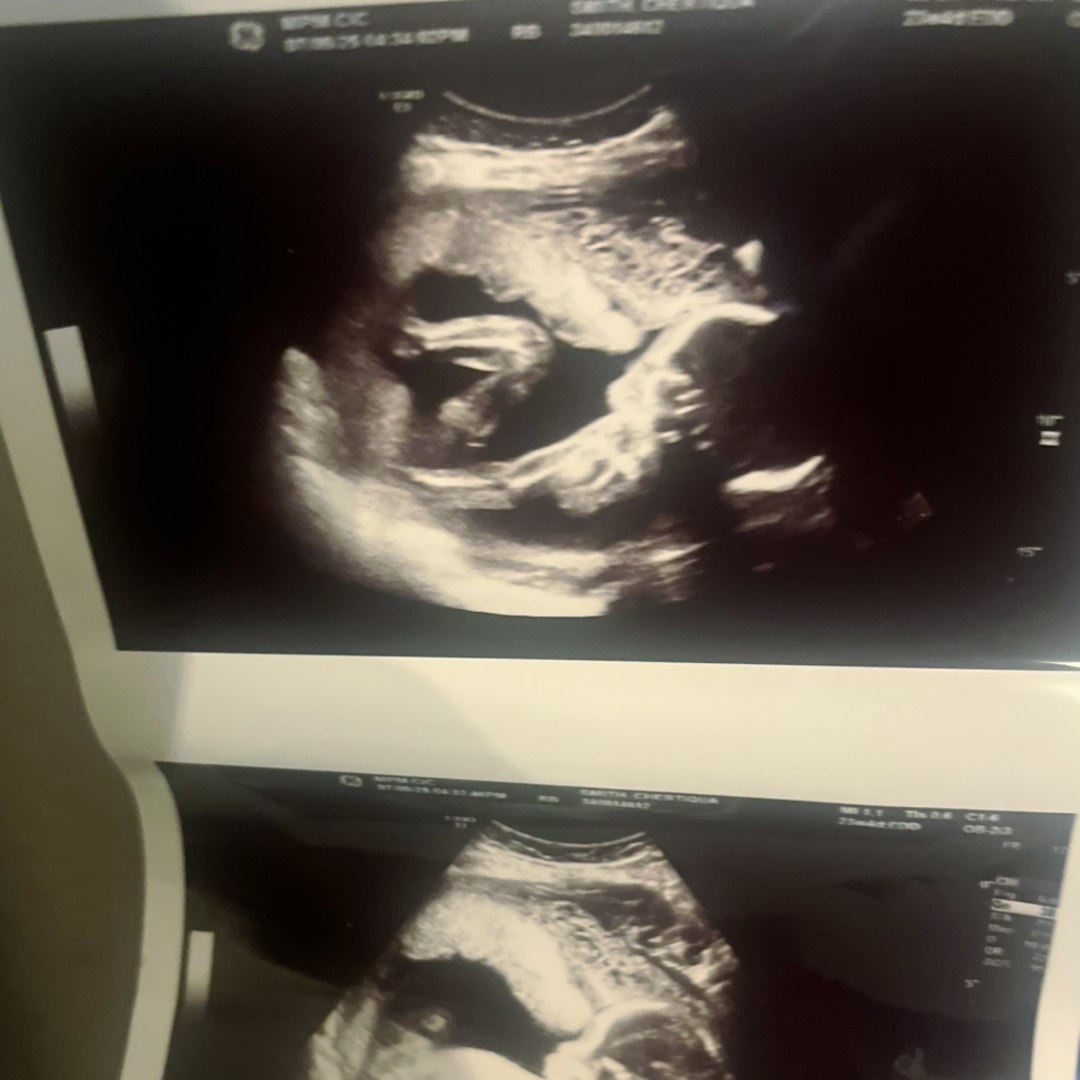 Photo shared by Chertiqua for their Babylist baby registry.